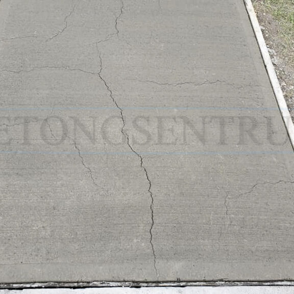 Plastisk svinn Plastisk svinn